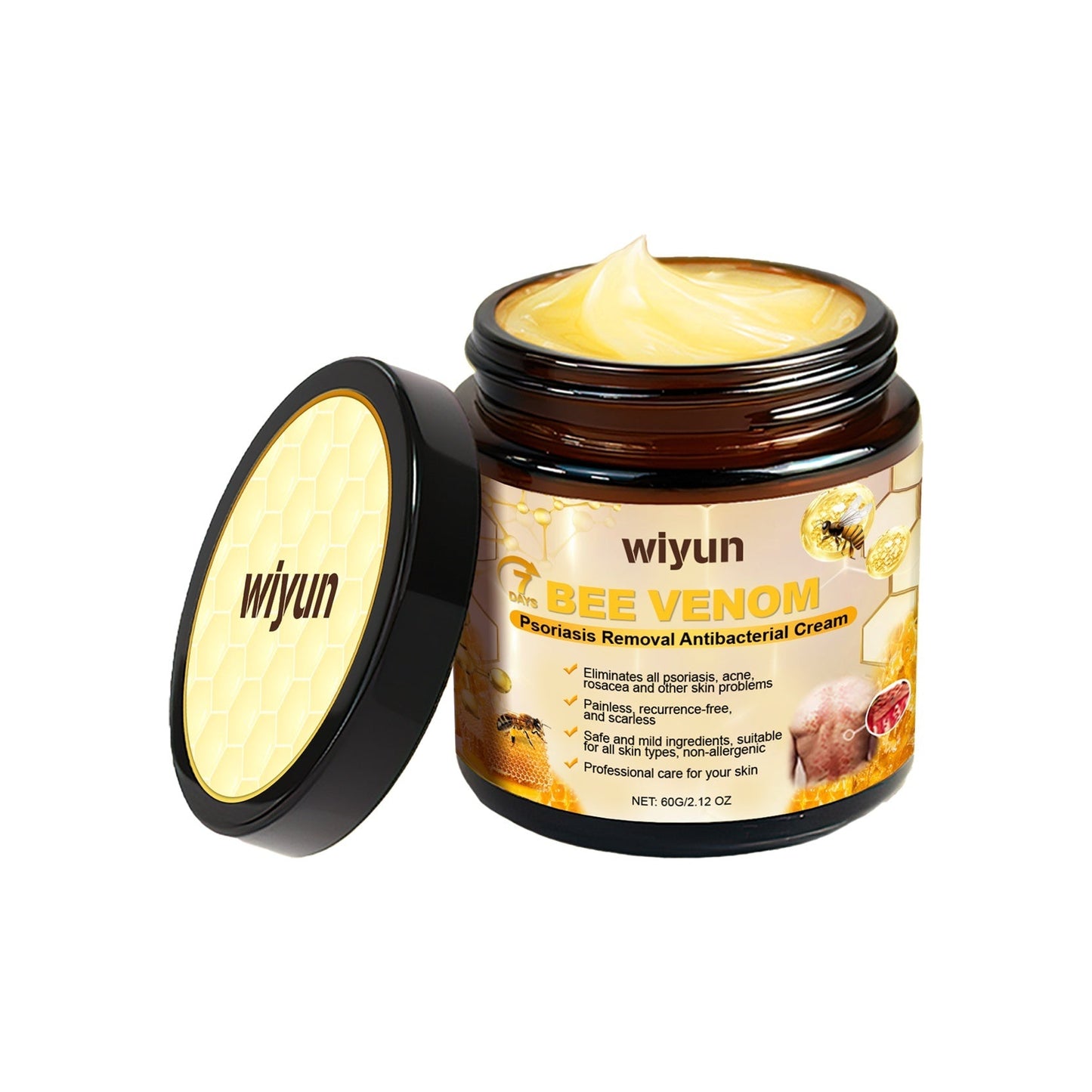 Psoriasis Antibacterial Cream