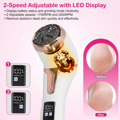 17Pcs Electric Foot Callus Remover with Vacuum Foot Grinder Rechargeable Foot File Dead Skin Pedicure Machine with 3 Grinding Heads 2 Speeds Foot Care
