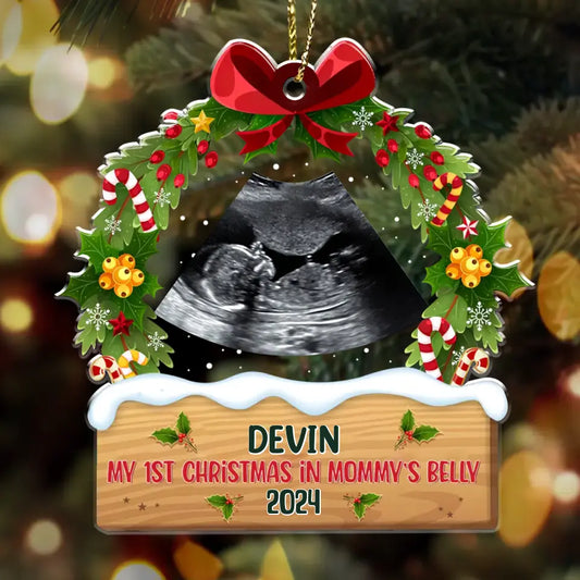 Personalized Baby First Christmas Acrylic Ornament - Upload Photo - Christmas Gift For Family/New Mom Dad - My 1st Christmas In Mommy's Belly