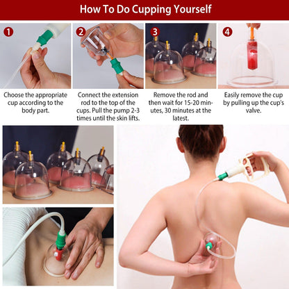 32 Cups Chinese Massage Therapy Cupping Set Body Vacuum Suction Kit Acupoint Massage Kit